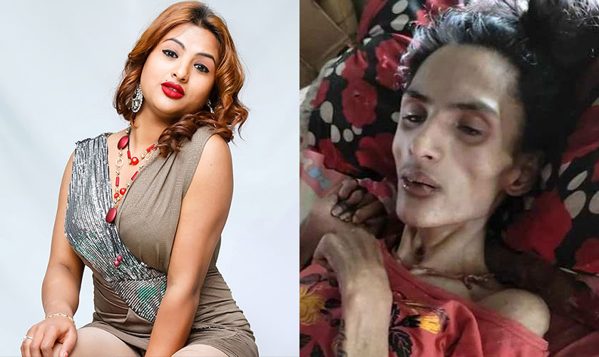 मेघा चौधरीको पहलमा मोडेल तथा कलाकार निशाको उपचार सुरु 