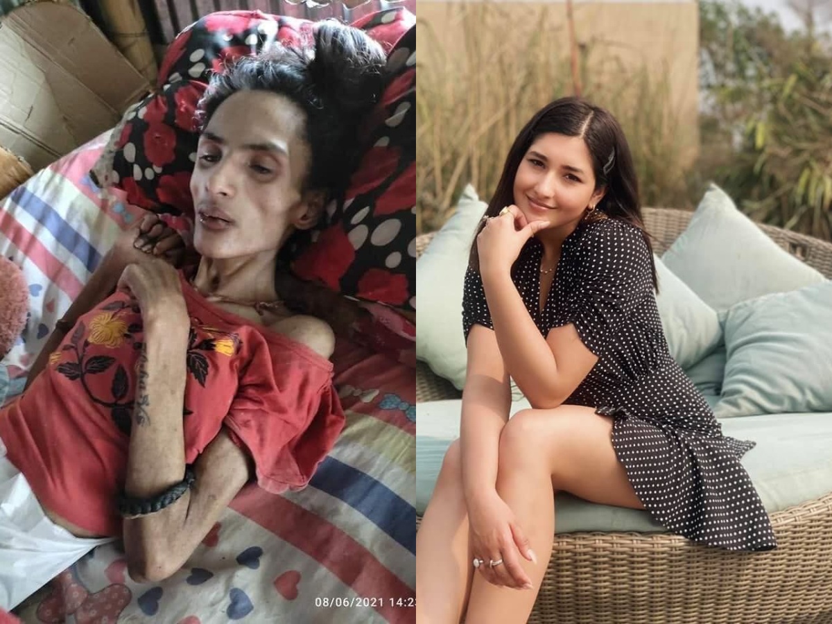 निशा घिमिरेलाई आँचलको एक लाख सहयोग