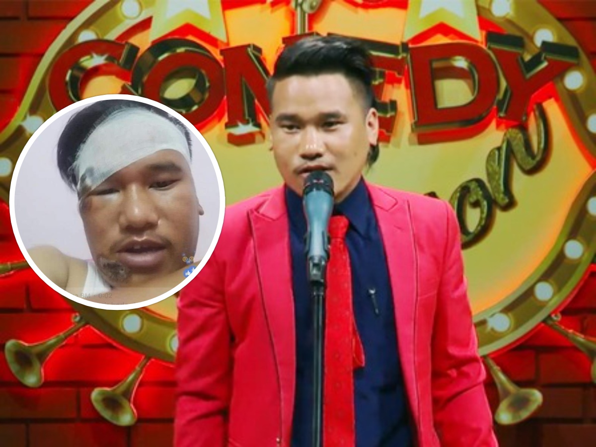 हाँस्य कलाकार खबपु दुर्घटनामा घाइते