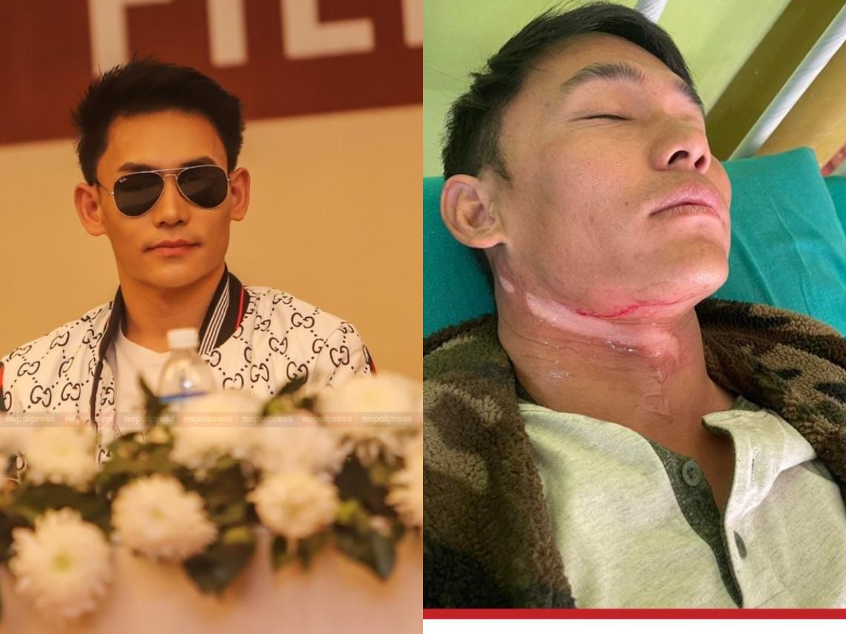 &lsquo;गोर्खा वारियर २&rsquo; छायाङ्कनको क्रममा हिरो भीरबाट खसेर घाइते  