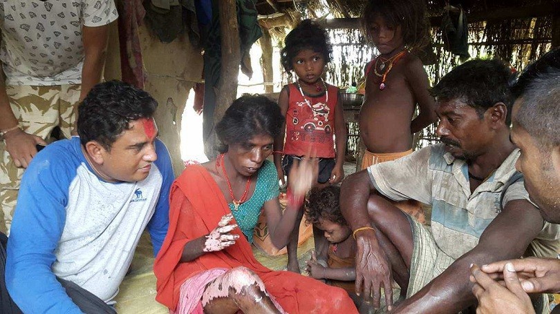 हात, खुट्टा डढेकी महिलालाई &lsquo;धुमुर्स&rsquo; यसरी पुराए अस्पताल&nbsp;